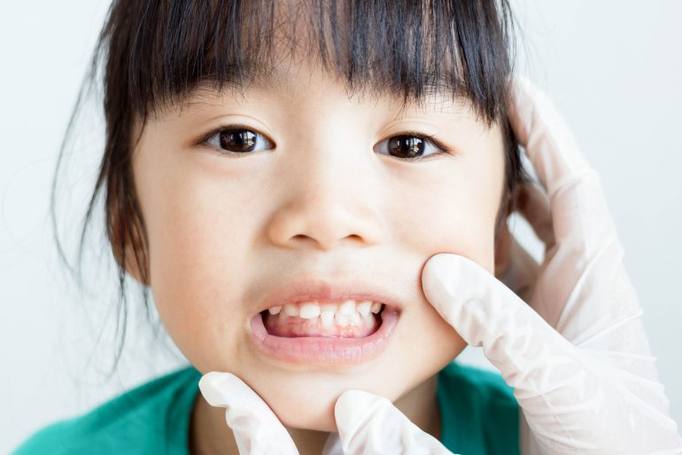 乳歯の抜け始める時期；6〜12歳前後
